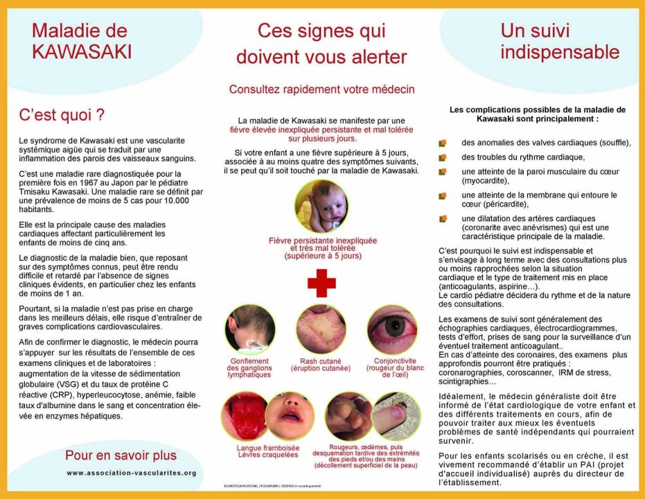 découvrez la maladie de kawasaki, une affection pédiatrique rare caractérisée par une inflammation des vaisseaux sanguins. apprenez ses symptômes, ses causes, son diagnostic et les options de traitement disponibles pour garantir la santé et le bien-être de votre enfant.